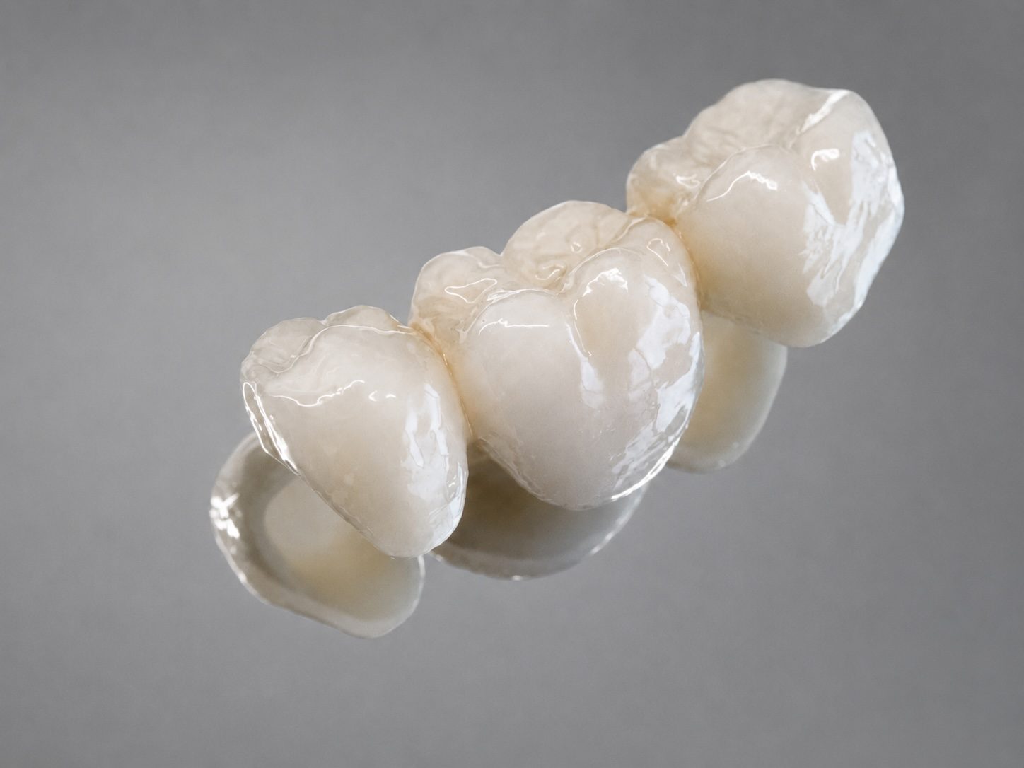 Dental bridge — Element Dental