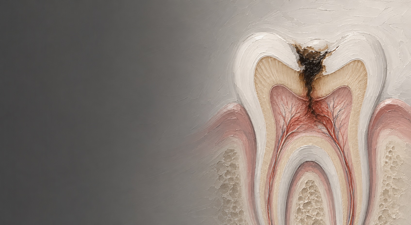Root Canal Therapy Element Dental