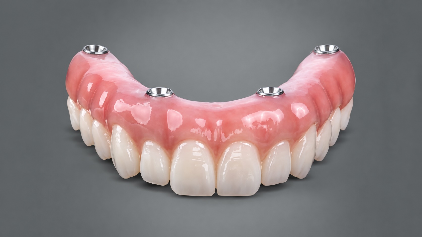 All-On-4 Implants Element Dental